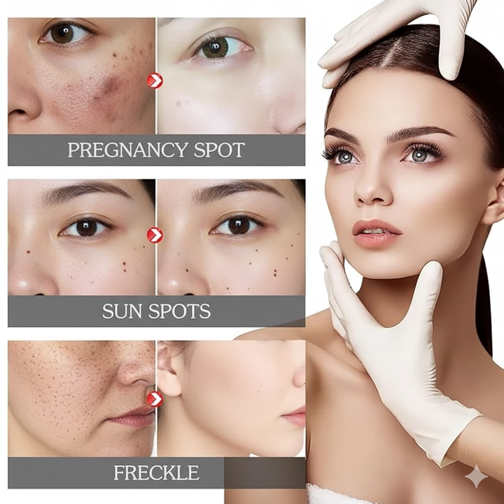 “Eelhoe Pigment Correcting Cream – Brighten & Fade Dark Spots (Original)”