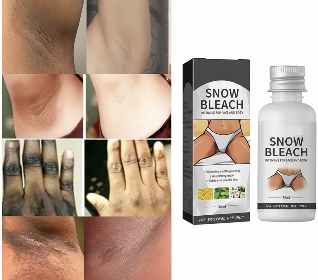 “Dark Spot Remover Cream – Fade Pigmentation & Brighten Skin Naturally”