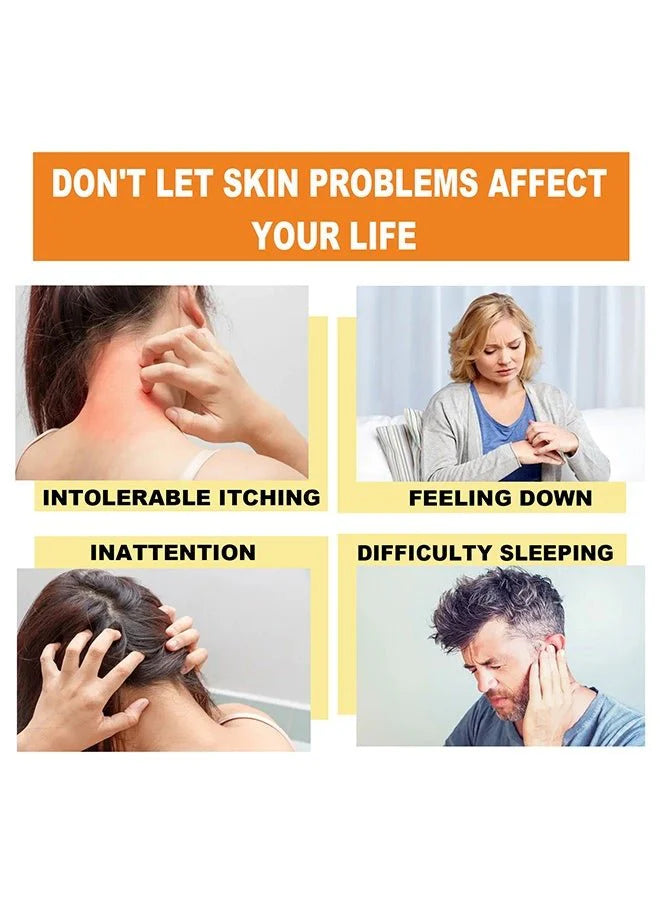 “South Moon - Bee Venom Psoriasis Care Cream (Original)”