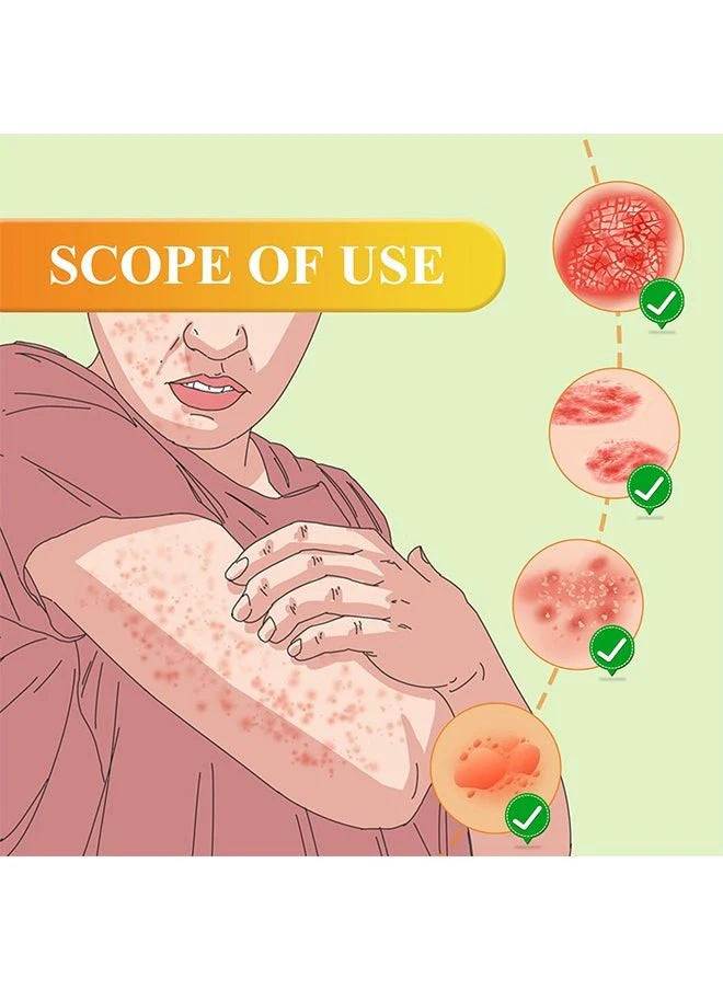 “South Moon - Bee Venom Psoriasis Care Cream (Original)”