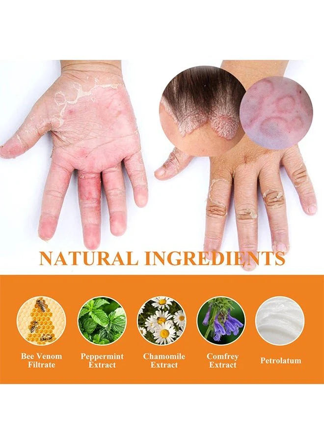 “South Moon - Bee Venom Psoriasis Care Cream (Original)”